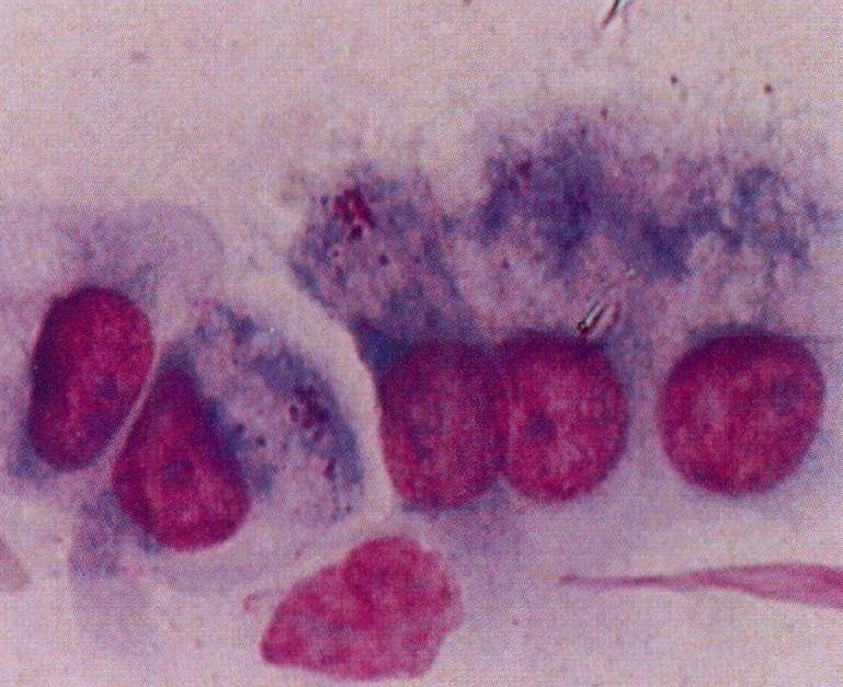 图2-16 黏液柱上皮细胞